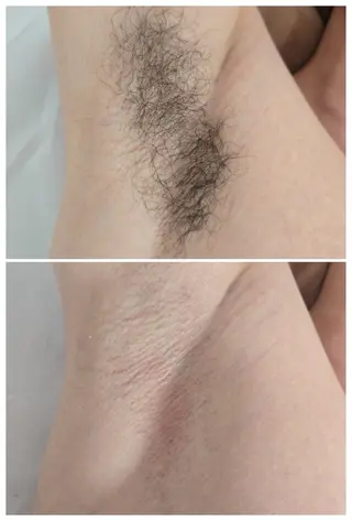 TAKAMATSU RINAのネイルデザイン