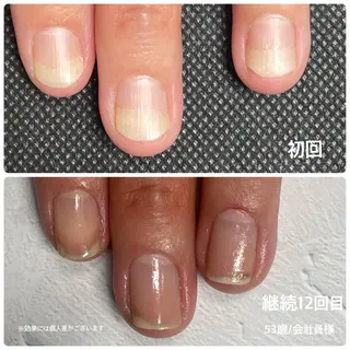 ネイル 奥園 良恵のネイルデザイン