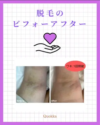 Quokka ✴︎ あま市甚目寺のエステ・リラクイメージ