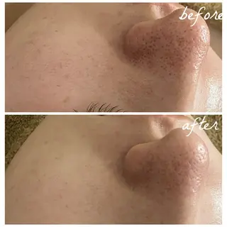 メンズ メナード岐阜市茜部 杉浦のエステ・リラクイメージ