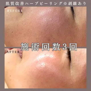 肌質改善専門サロン Bellmi/心斎橋のエステ・リラクイメージ