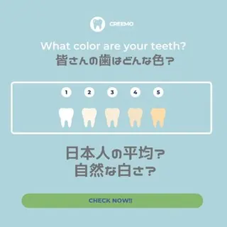 歯のホワイトニング HARU南浦和のその他イメージ