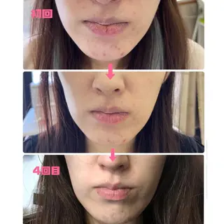 デ･アイム福岡西所属・米田 ひかるのエステ・リラクイメージ