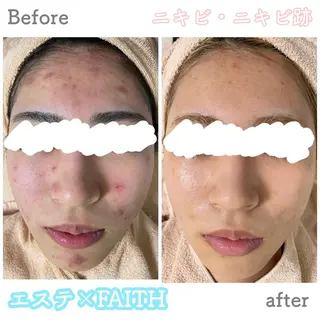 ショート カラー パーマ ヘアアレンジ メンズ キッズ ネイル マツエク・マツパ アイブロウ ニキビ&跡改善サロン オーナー光木のエステ・リラクイメージ