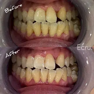 メンズ キッズ ホワイトニングサロン Ecru所属・ホワイトニングサロン Ecru エクリュのエステ・リラクイメージ