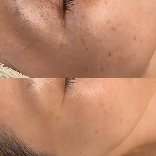 hm NATURESKINのエステ・リラクイメージ