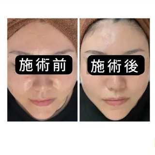 渋谷 小顔美容鍼 専門サロン YZのエステ・リラクイメージ