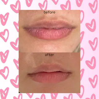 歌舞伎町深夜サロン to mëのエステ・リラクイメージ