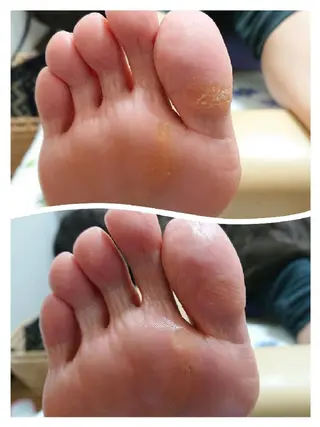 ネイル あんきち    のネイルデザイン