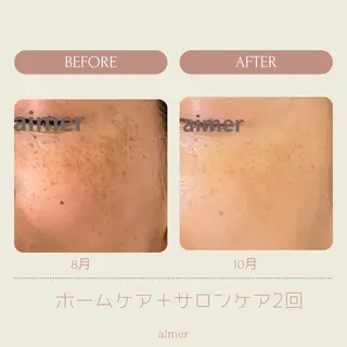 aimer beautyのエステ・リラクイメージ