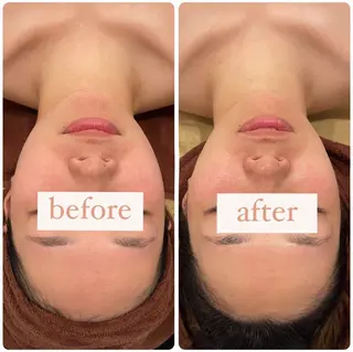 立体小顔×艶肌×美ボ ディ似合わせ施術 岡のエステ・リラクイメージ