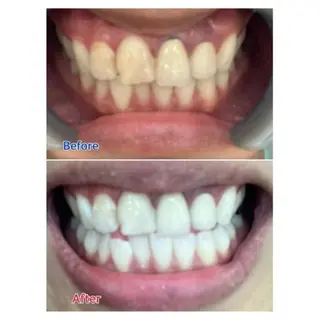 M渋谷店所属・M渋谷 ホワイトニングのエステ・リラクイメージ