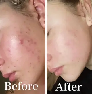 Blooming所属・LOUISE. ／肌質・頭皮のエステ・リラクイメージ