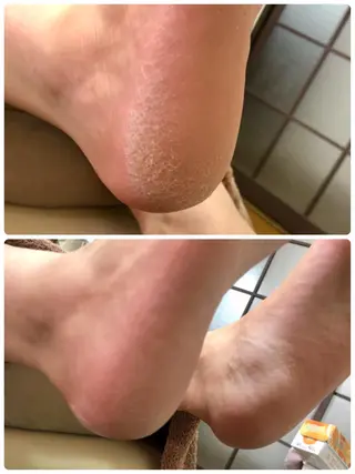 ❤︎MN❤︎ モンのエステ・リラクイメージ