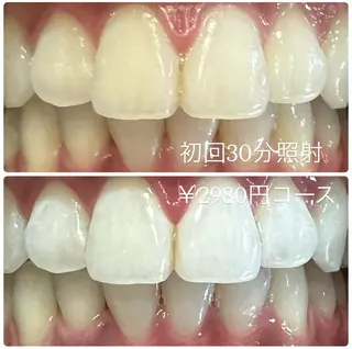 PLATINUM Beauty 横浜店所属・ホワイトニングルーム 横浜店のその他イメージ