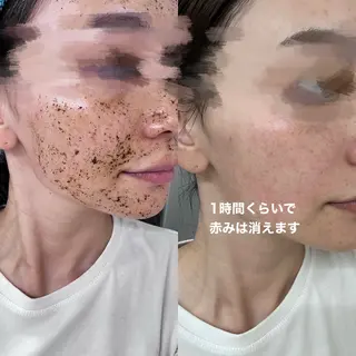 salon moi(モア)のエステ・リラクイメージ