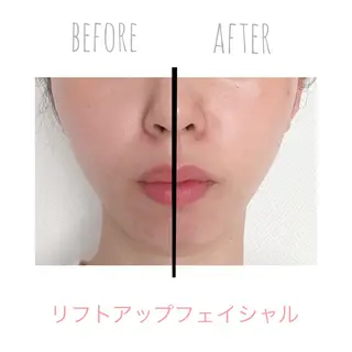 妊活・婦人科お悩み Moonbowのエステ・リラクイメージ