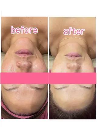 脱毛&フェイシャル BiSTA〈ビスタ〉のエステ・リラクイメージ