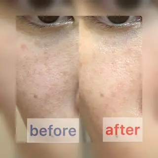 メナードフェイシャルサロン小山東城南所属・村田 結加のエステ・リラクイメージ