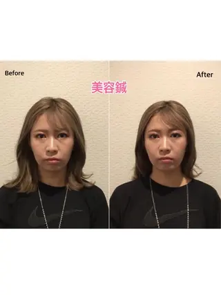 チキバン美容鍼灸整体 サロン心斎橋店のエステ・リラクイメージ