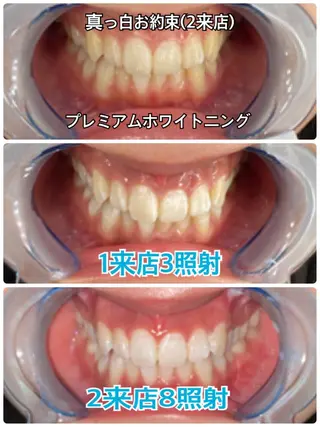 Platinum Beauty 四条烏丸店所属・吉田亮利 ホワイトニング専門店のその他イメージ