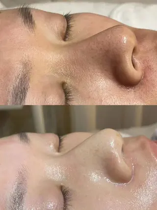 ホワイトビューティ サロンのエステ・リラクイメージ