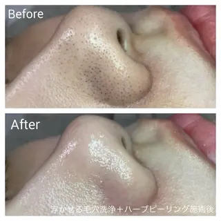 深い肌悩み専門 フェイシャルサロンのエステ・リラクイメージ