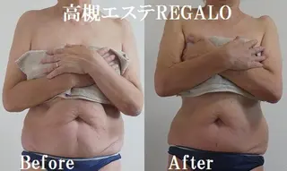 REGALO所属・矢野 さやかのエステ・リラクイメージ