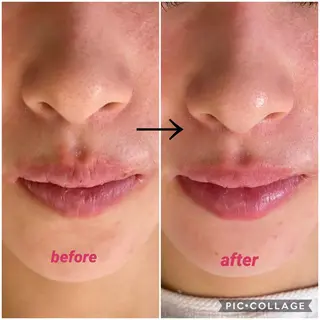 ナリスビューティーサロンつくば店所属・バストアップサロン -Sirius-かずのエステ・リラクイメージ