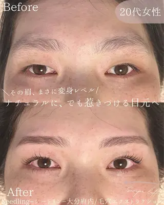 アイブロウ シードリン 府内店 小波のエステ・リラクイメージ