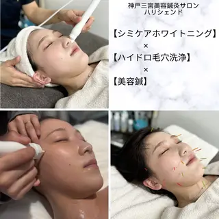 美容鍼・小顔矯正 ハリシェンドのエステ・リラクイメージ