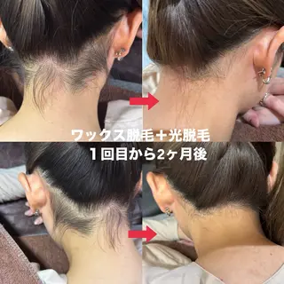 ワックス脱毛サロン 🎀新宿駅徒歩5分のエステ・リラクイメージ