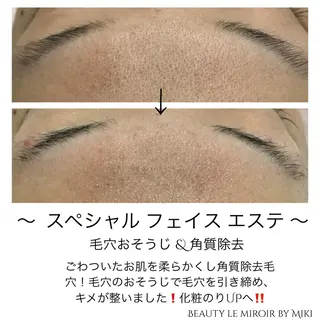 ビューティー ミロワールのエステ・リラクイメージ