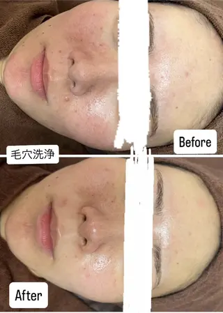 salon de off 御堂筋店所属・✨️韓国肌管理✨️ madokaのエステ・リラクイメージ