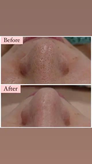 ハーブピーリング専門 muro.のエステ・リラクイメージ