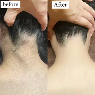 美肌・脱毛専門　Beauty lodge所属・ビューティー ロッジのエステ・リラクイメージ