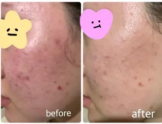 ulu. (ユール)のエステ・リラクイメージ