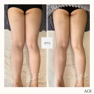 salon shares 辻堂店所属・SHARES AOIのエステ・リラクイメージ