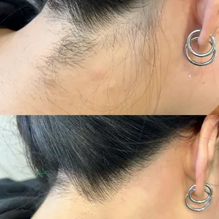 Remove所属・Remove .のエステ・リラクイメージ