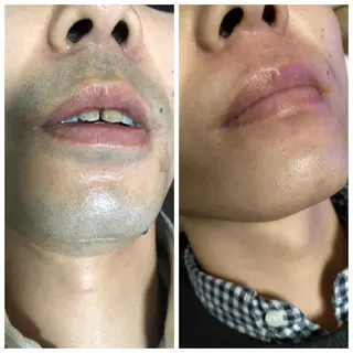 メンズ muscle＆esthe jonny's beauty所属・jonny's beautyのエステ・リラクイメージ