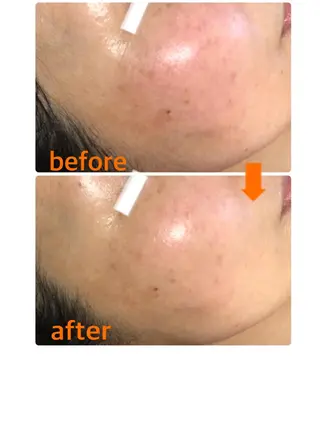 小顔・毛穴・たるみ ネイル　似内真樹のエステ・リラクイメージ