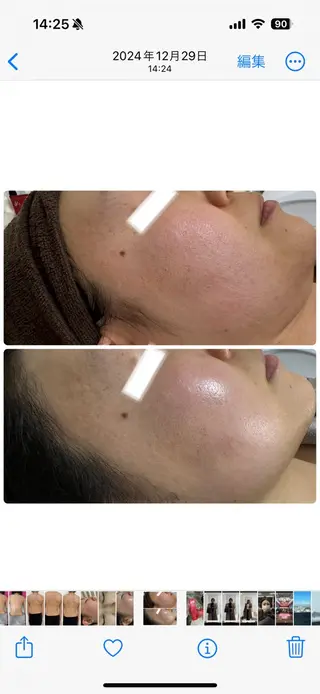 Esthe salon Blanche(エステサロンブランシュ)所属・小顔リフトアップ 美肌改善専門店のエステ・リラクイメージ