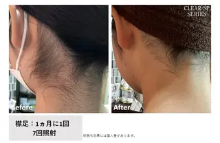 E'clat所属・E'clat Kanaのエステ・リラクイメージ