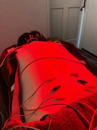 美容鍼灸整体サロンBeauJu所属・小顔矯/美容鍼/鍼灸 BeauJuのその他イメージ