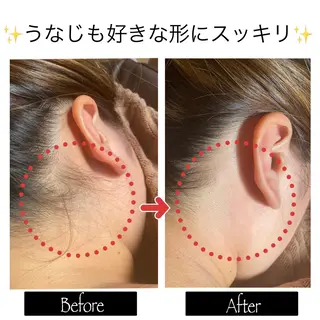 脱毛MAX南越谷所属・脱毛MAX 店長まなみのエステ・リラクイメージ