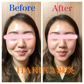 HARIKA鍼灸所属・HARIKA 鍼灸のその他イメージ