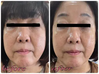 Eyelash Salon 4Uのマツエク・マツパデザイン