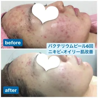 透明感の肌Lino malieのエステ・リラクイメージ