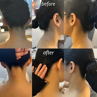 うなじ脱毛/美肌脱毛 LABELのエステ・リラクイメージ