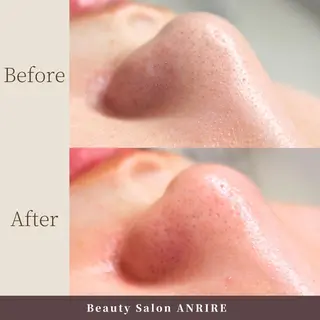 ANRIRE (アンリール)のエステ・リラクイメージ